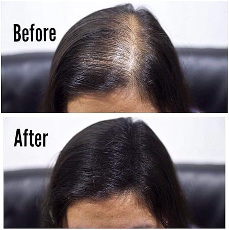 THICK FIBER - Hair Fibers for Thinning Hair